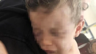 Denizli'de şok eden olay: 2 yaşındaki Aren bebek hastanelik oldu, aile gözaltında
