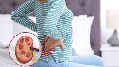 Böbrek Hastalıkları Nelerdir? Belirtileri ve Tedavi Yöntemleri