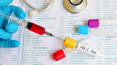 HDL Kolesterol Nedir?