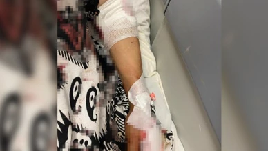 Kartepe’de kadına köpekler saldırdı